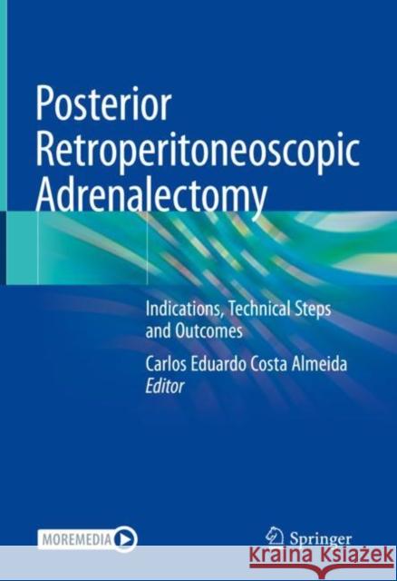 Posterior Retroperitoneoscopic Adrenalectomy: Indications, Technical Steps and Outcomes Carlos E. Cost 9783031199943 Springer - książka
