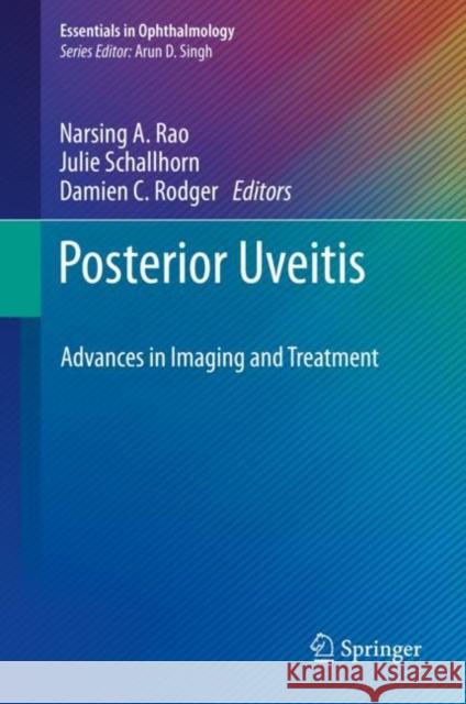 Posterior Uveitis: Advances in Imaging and Treatment Rao, Narsing A. 9783030031398 Springer - książka