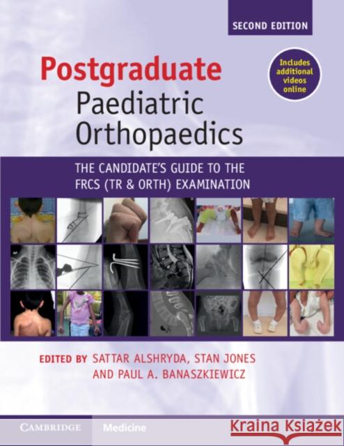 Postgraduate Paediatric Orthopaedics: The Candidate's Guide to the Frcs(tr&orth) Examination Alshryda, Sattar 9781108970617 Cambridge University Press - książka