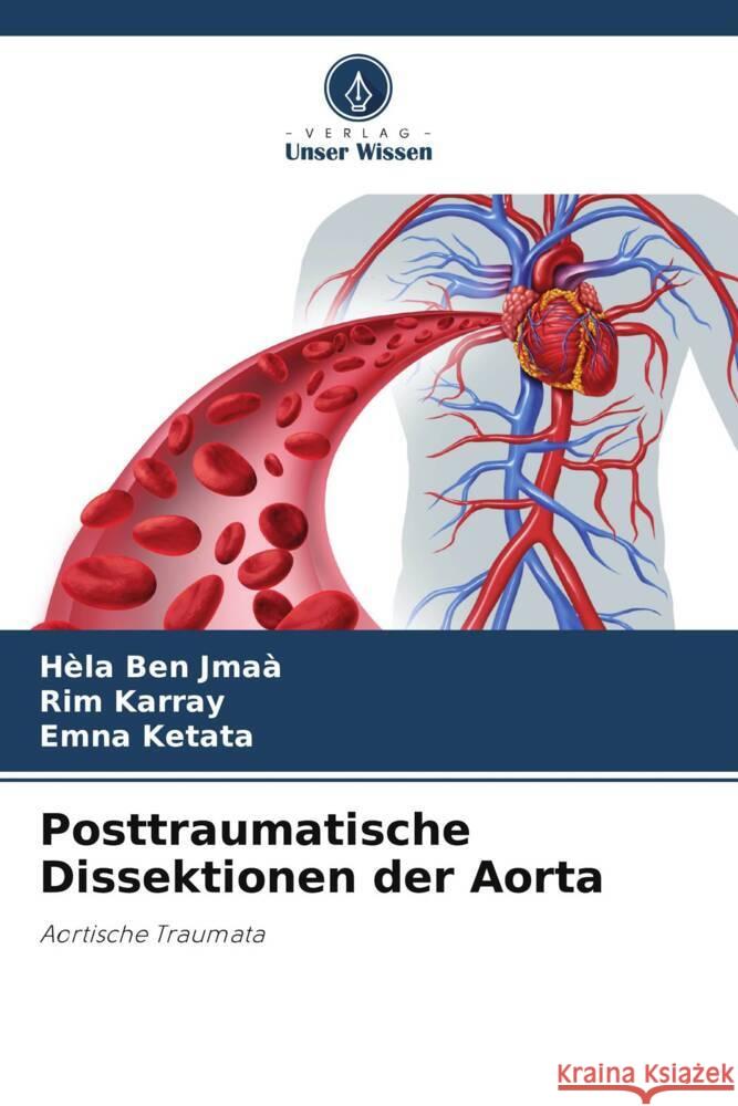 Posttraumatische Dissektionen der Aorta H?la Be Rim Karray Emna Ketata 9786207983803 Verlag Unser Wissen - książka