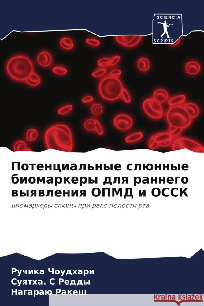 Potencial'nye slünnye biomarkery dlq rannego wyqwleniq OPMD i OSSK Choudhari, Ruchika, Reddy, Suqtha. S, Rakesh, Nagaraü 9786204657325 Sciencia Scripts - książka