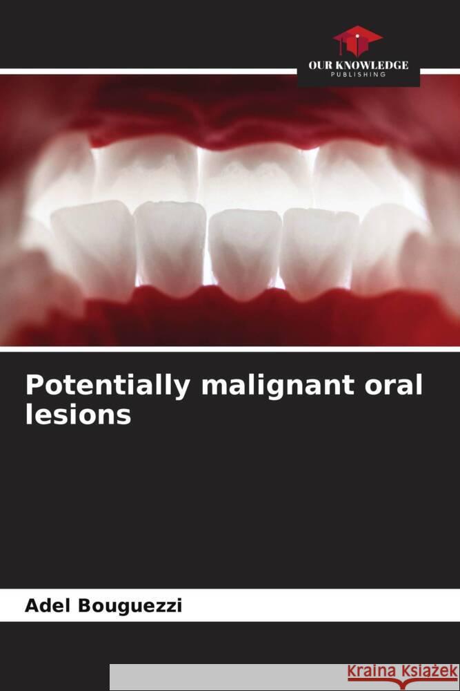 Potentially malignant oral lesions Adel Bouguezzi 9786208580292 Our Knowledge Publishing - książka