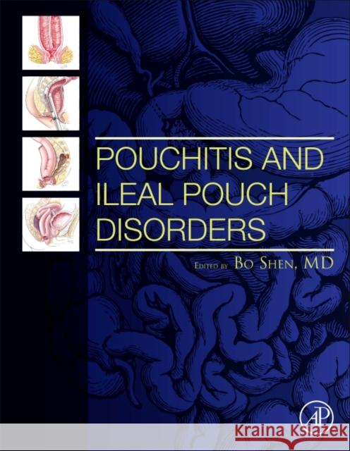 Pouchitis and Ileal Pouch Disorders: A Multidisciplinary Approach for Diagnosis and Management Bo Shen 9780128094020 Academic Press - książka