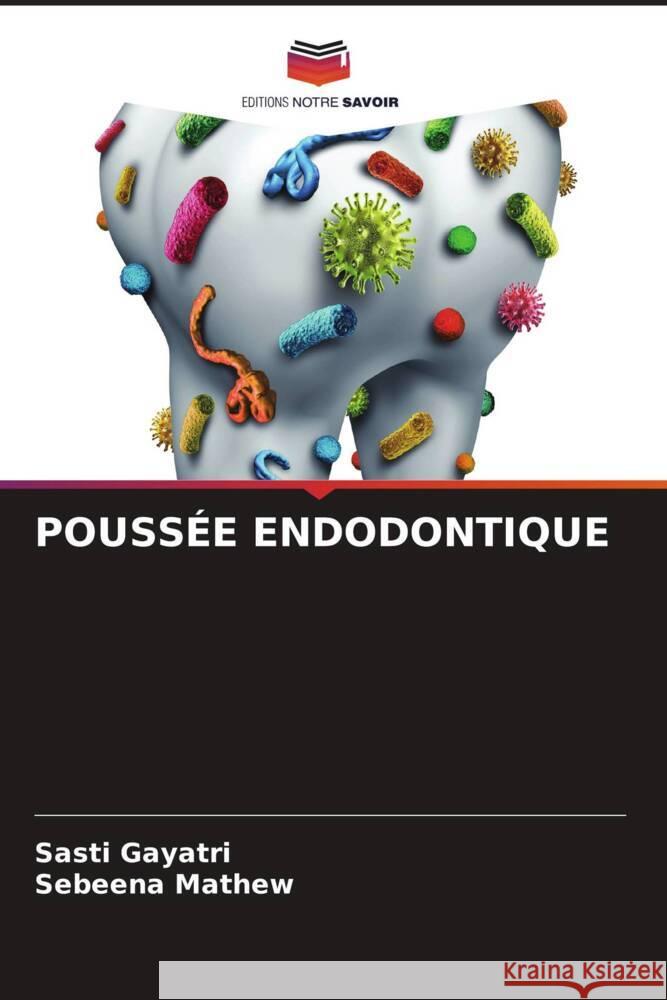 Pouss?e Endodontique Sasti Gayatri Sebeena Mathew 9786207200702 Editions Notre Savoir - książka