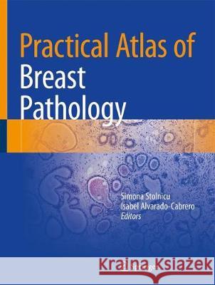 Practical Atlas of Breast Pathology Simona Stolnicu Isabel Alvarado-Cabrero 9783319932569 Springer - książka