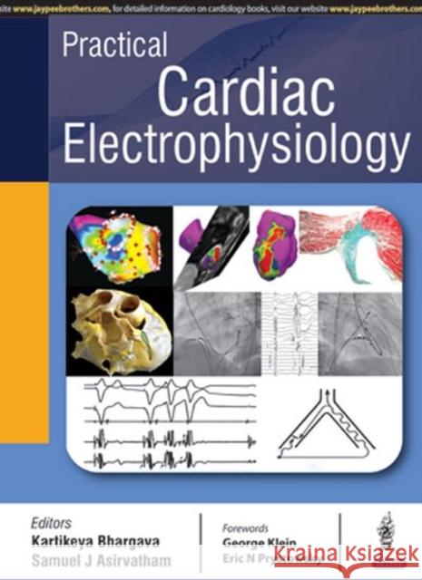 Practical Cardiac Electrophysiology Kartikeyan Bhargava 9789386056795 Jaypee Brothers, Medical Publishers Pvt. Ltd. - książka