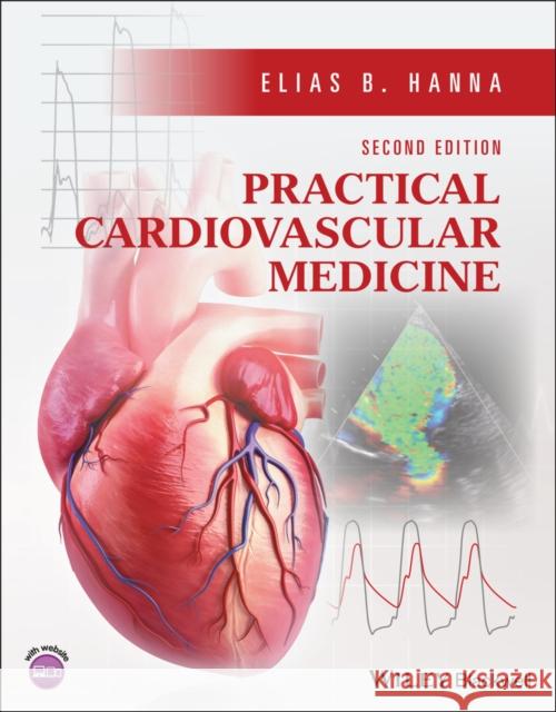 Practical Cardiovascular Medicine Elias B. (Louisiana State University School of Medicine, New Orleans, LA, USA) Hanna 9781119832706 John Wiley and Sons Ltd - książka