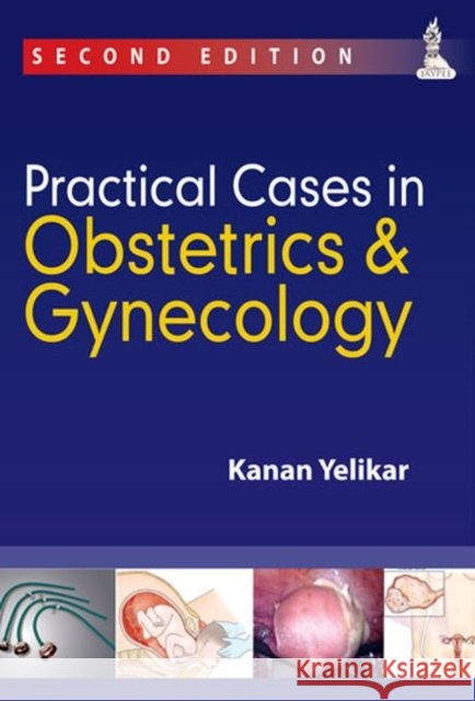Practical Cases in Obstetrics & Gynecology Kanan Yelikar 9789350905364 JP Medical Ltd - książka