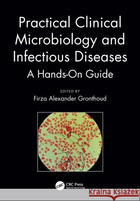 Practical Clinical Microbiology and Infectious Diseases: A Hands-On Guide Gronthoud, Firza Alexander 9781138721715 CRC Press - książka