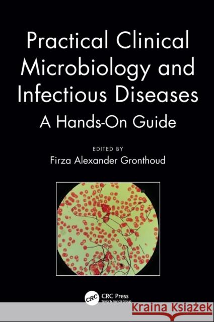 Practical Clinical Microbiology and Infectious Diseases: A Hands-On Guide Gronthoud, Firza Alexander 9781138721753 CRC Press - książka