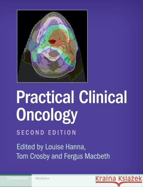 Practical Clinical Oncology Louise Hanna Tom Crosby Fergus Macbeth 9781107683624 Cambridge University Press - książka