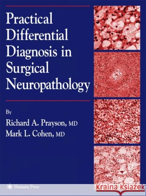 Practical Differential Diagnosis in Surgical Neuropathology Richard A. Prayson Mark L. Cohen 9780896038172 Humana Press - książka