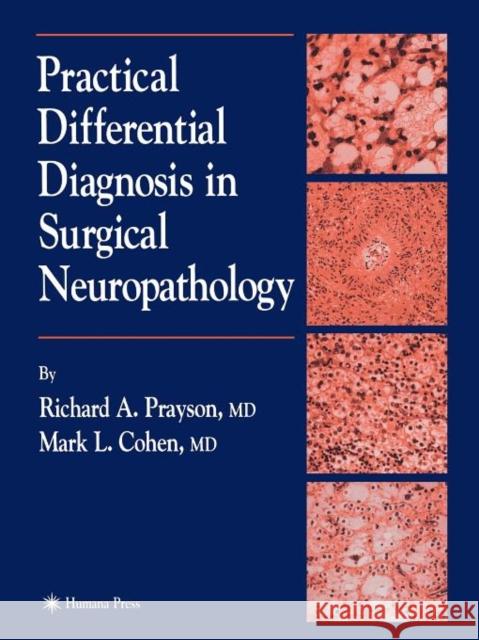 Practical Differential Diagnosis in Surgical Neuropathology Richard A. Prayson Mark L. Cohen 9781617372018 Springer - książka