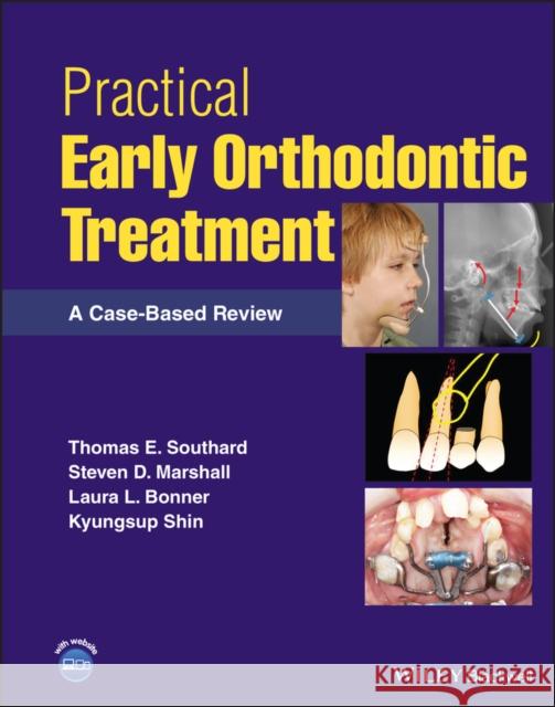 Practical Early Orthodontic Treatment: A Case-Based Review Southard, Thomas E. 9781119793595  - książka