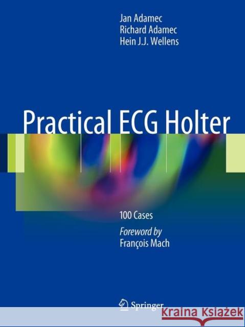 Practical ECG Holter: 100 Cases Adamec, Jan 9781441999542 Springer, Berlin - książka