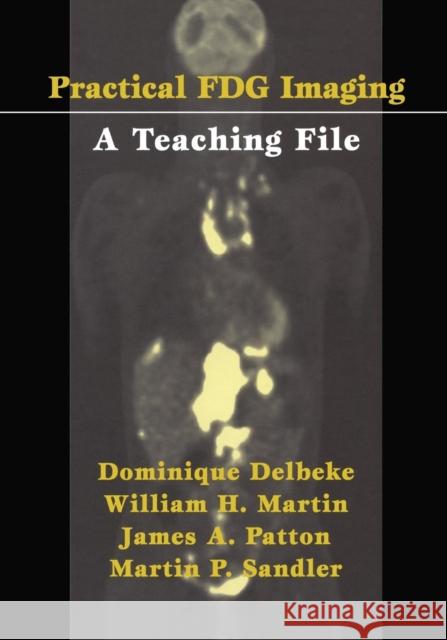 Practical Fdg Imaging: A Teaching File Delbeke, Dominique 9781475776881 Springer - książka