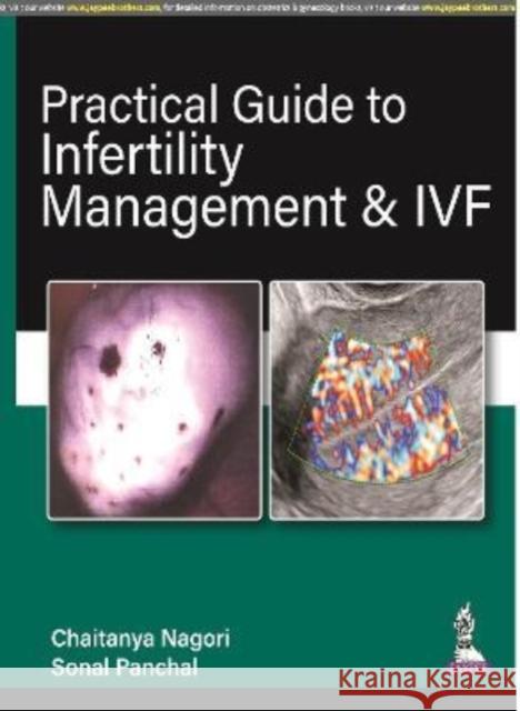 Practical Guide to Infertility Management & IVF Chaitanya Nagori, Sonal Panchal 9789390595914 JP Medical Publishers (RJ) - książka