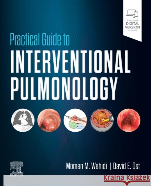 Practical Guide to Interventional Pulmonology Momen M. Wahidi David E. Ost 9780323709545 Elsevier - Health Sciences Division - książka