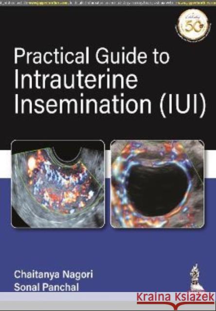 Practical Guide to Intrauterine Insemination (IUI) Chaitanya Nagori Sonal Panchal  9789390595167 Jaypee Brothers Medical Publishers - książka