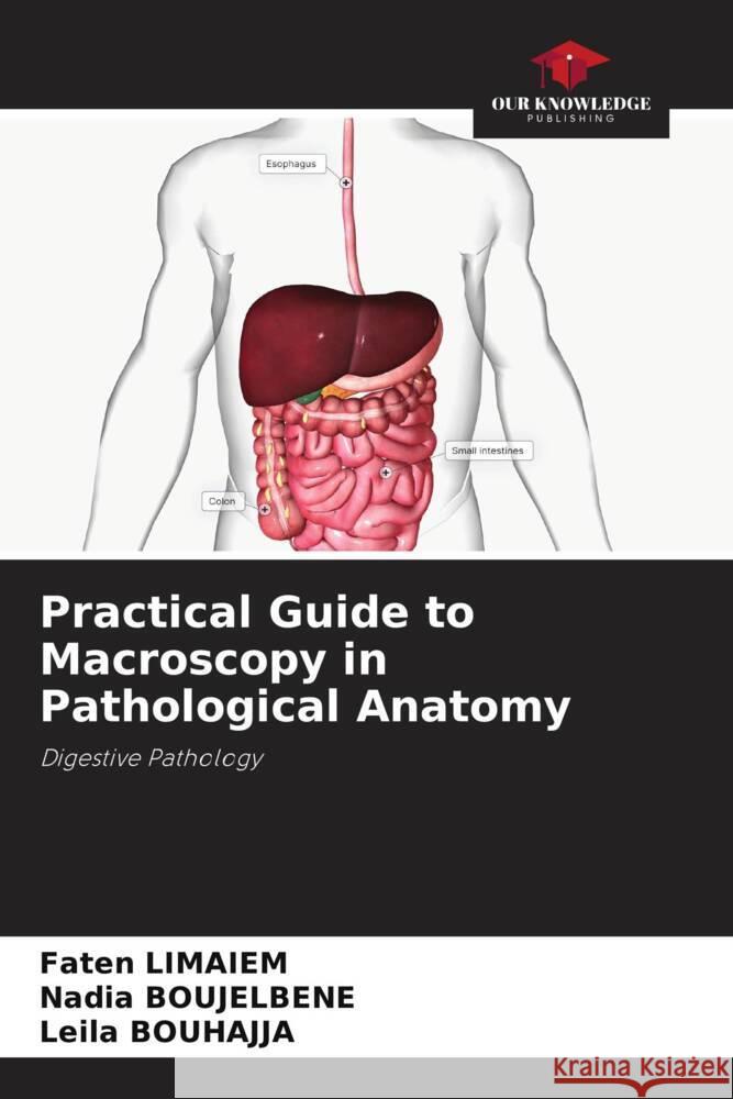 Practical Guide to Macroscopy in Pathological Anatomy Limaiem, Faten, BOUJELBENE, Nadia, BOUHAJJA, Leila 9786200438546 Our Knowledge Publishing - książka