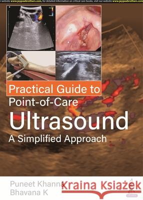 Practical Guide to Point of Care Ultrasound: A Simplified Approach Puneet Khanna Bhavana K  9789354655623 Jaypee Brothers Medical Publishers - książka