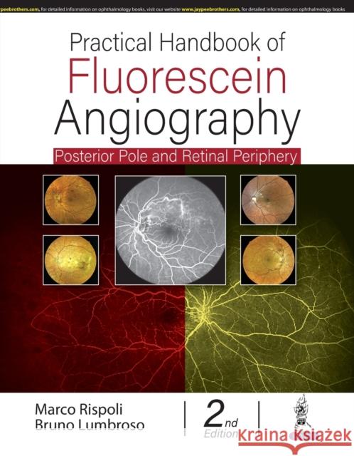 Practical Handbook of Fluorescein Angiography: Posterior Pole and Retinal Periphery Marco Rispoli, Bruno Lumbroso 9789354657894 Jaypee Brothers Medical Publishers - książka