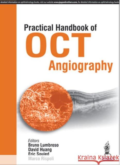 Practical Handbook of Oct Angiography Lumbroso, Bruno|||Huang, David|||Rispoli, Marco 9789385999970  - książka