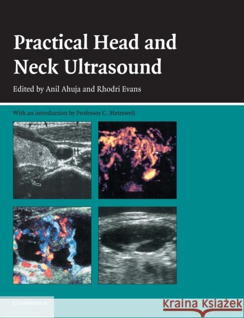 Practical Head & Neck Ultrasound Ahuja, Anil T. 9780521683210  - książka