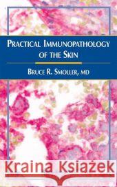 Practical Immunopathology of the Skin Bruce R. Smoller 9781588291493 Humana Press - książka