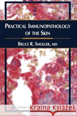 Practical Immunopathology of the Skin Bruce R. Smoller 9781617373893 Springer - książka
