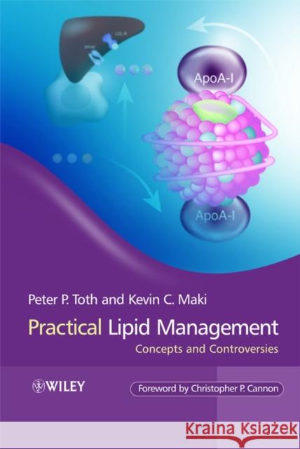 Practical Lipid Management: Concepts and Controversies Toth, Peter P. 9780470056905 John Wiley & Sons - książka