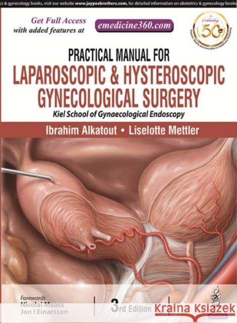 Practical Manual for Laparoscopic & Hysteroscopic Gynecological Surgery Ibrahim Alkatout Liselotte Mettler  9789352701940 Jaypee Brothers Medical Publishers - książka