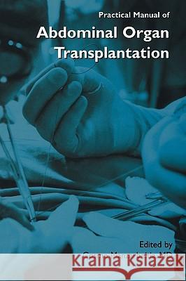 Practical Manual of Abdominal Organ Transplantation Cosme Manzarbeitia Cosme Manzarbeitia 9780306466397 Kluwer Academic Publishers - książka