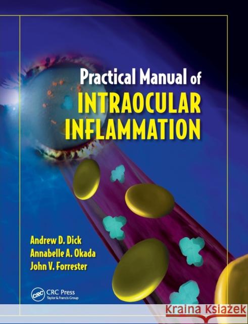 Practical Manual of Intraocular Inflammation Andrew Dick Annabelle Okada John Forrester 9780367387204 CRC Press - książka