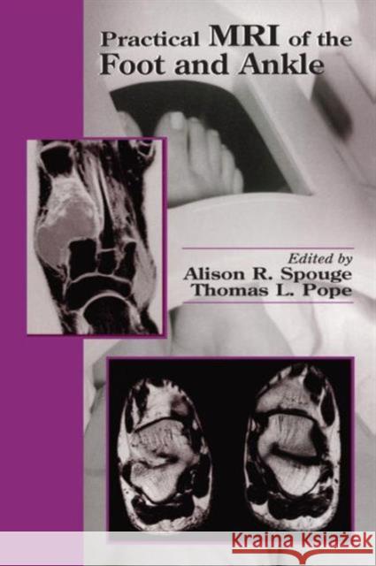 Practical MRI of the Foot and Ankle Alison R. Spouge Thomas L. Pope Thomas Lee Pope 9780849302817 CRC Press - książka
