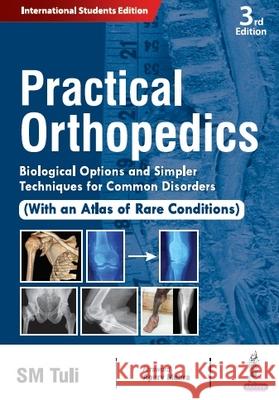 Practical Orthopedics SM Tuli 9789356964334 Jaypee Brothers Medical Publishers - książka