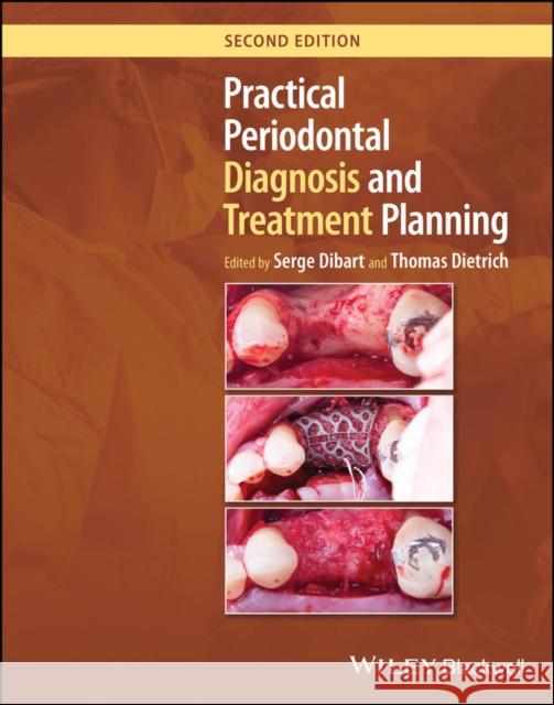 Practical Periodontal Diagnosis and Treatment Plan ning Dibart 9781119830313 John Wiley and Sons Ltd - książka