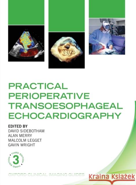 Practical Perioperative Transoesophageal Echocardiography David Sidebotham Alan Forbes Merry Malcolm E. Legget 9780198759089 Oxford University Press, USA - książka