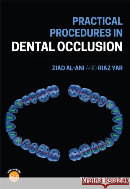 Practical Procedures in Dental Occlusion M. Ziad Al-Ani Riaz Yar 9781119678519 Wiley-Blackwell - książka