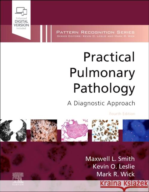 Practical Pulmonary Pathology: A Diagnostic Approach  9780323795470 Elsevier - Health Sciences Division - książka