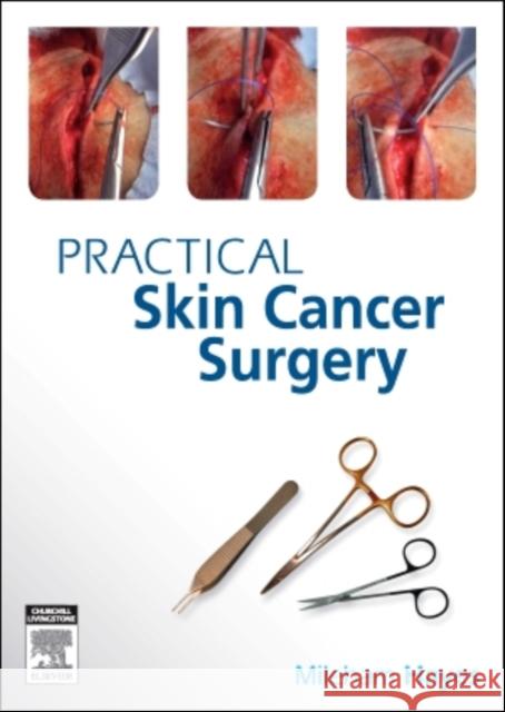 Practical Skin Cancer Surgery Anthony Dixon 9780729539326  - książka