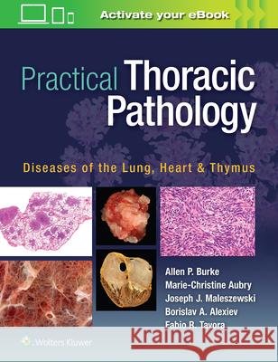 Practical Thoracic Pathology: Diseases of the Lung, Heart, and Thymus Burke, Allen P. 9781451193510 LWW - książka