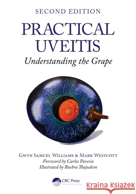 Practical Uveitis: Understanding the Grape Gwyn Samuel Williams Mark Westcott 9781032757230 CRC Press - książka