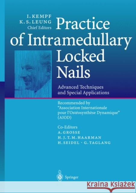 Practice of Intramedullary Locked Nails: Advanced Techniques and Special Applications Recommended by 