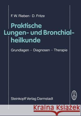 Praktische Lungen- Und Bronchialheilkunde: Grundlagen -- Diagnosen -- Therapie Rieben, F. W. 9783798506619 Not Avail - książka