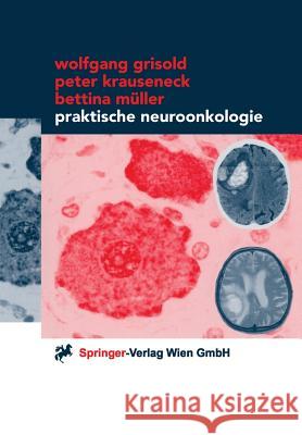 Praktische Neuroonkologie Wolfgang Grisold Peter Krauseneck Bettina M]ller 9783211832479 Springer - książka