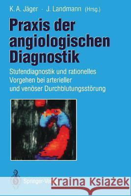 Praxis Der Angiologischen Diagnostik: Stufendiagnostik Und Rationelles Vorgehen Bei Arterieller Und Venöser Durchblutungsstörung Jäger, K. a. 9783642788758 Springer - książka