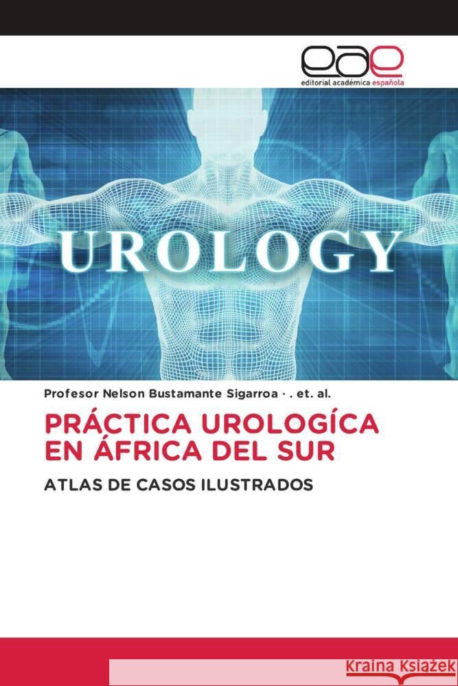 PRÁCTICA UROLOGÍCA EN ÁFRICA DEL SUR Bustamante Sigarroa, Nelson, et. al., . 9786203585384 Editorial Académica Española - książka