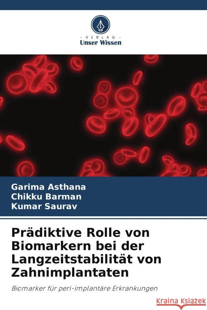 Prädiktive Rolle von Biomarkern bei der Langzeitstabilität von Zahnimplantaten Asthana, Garima, Barman, Chikku, Saurav, Kumar 9786205189863 Verlag Unser Wissen - książka