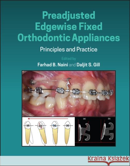 Preadjusted Edgewise Fixed Orthodontic Appliances: Principles and Practice Naini, Farhad B. 9781118817698 John Wiley & Sons Inc - książka